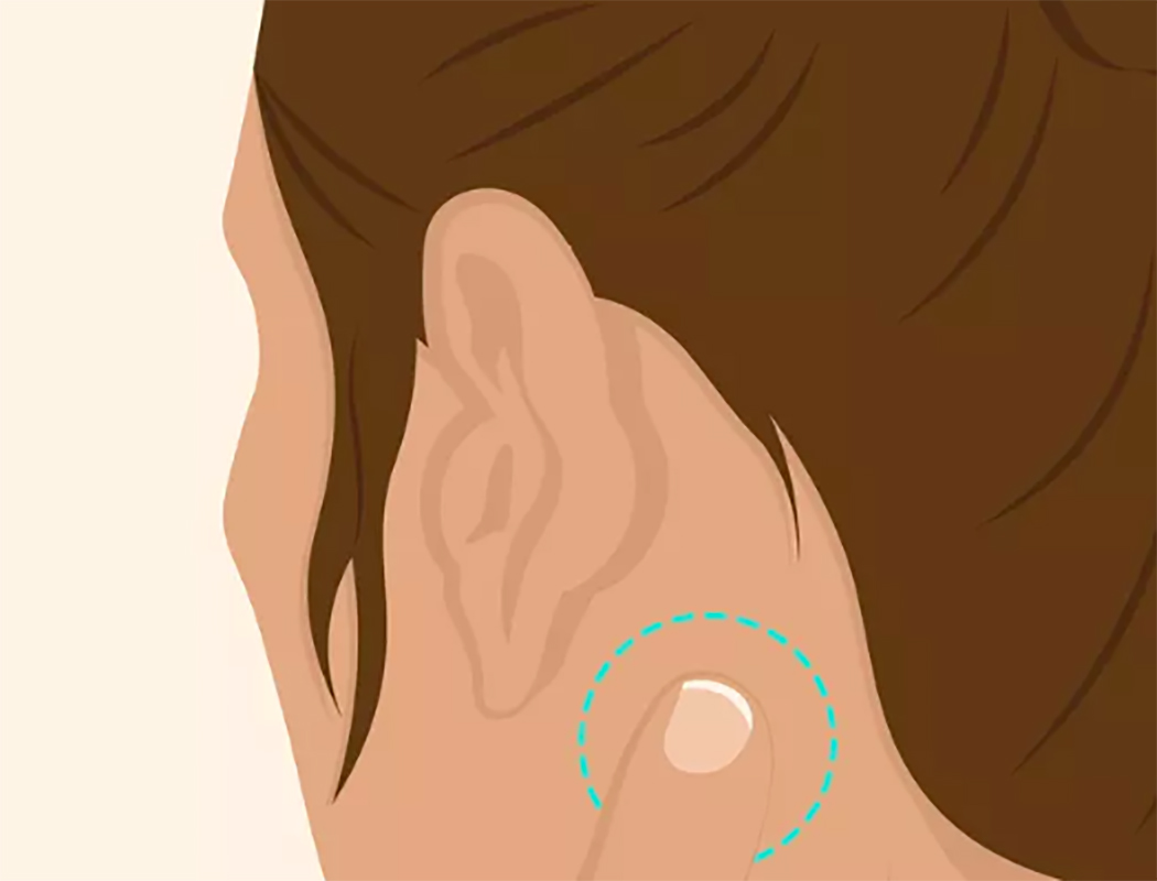 Акупунктура уха: точки на ухе, отвечающие за разные органы
